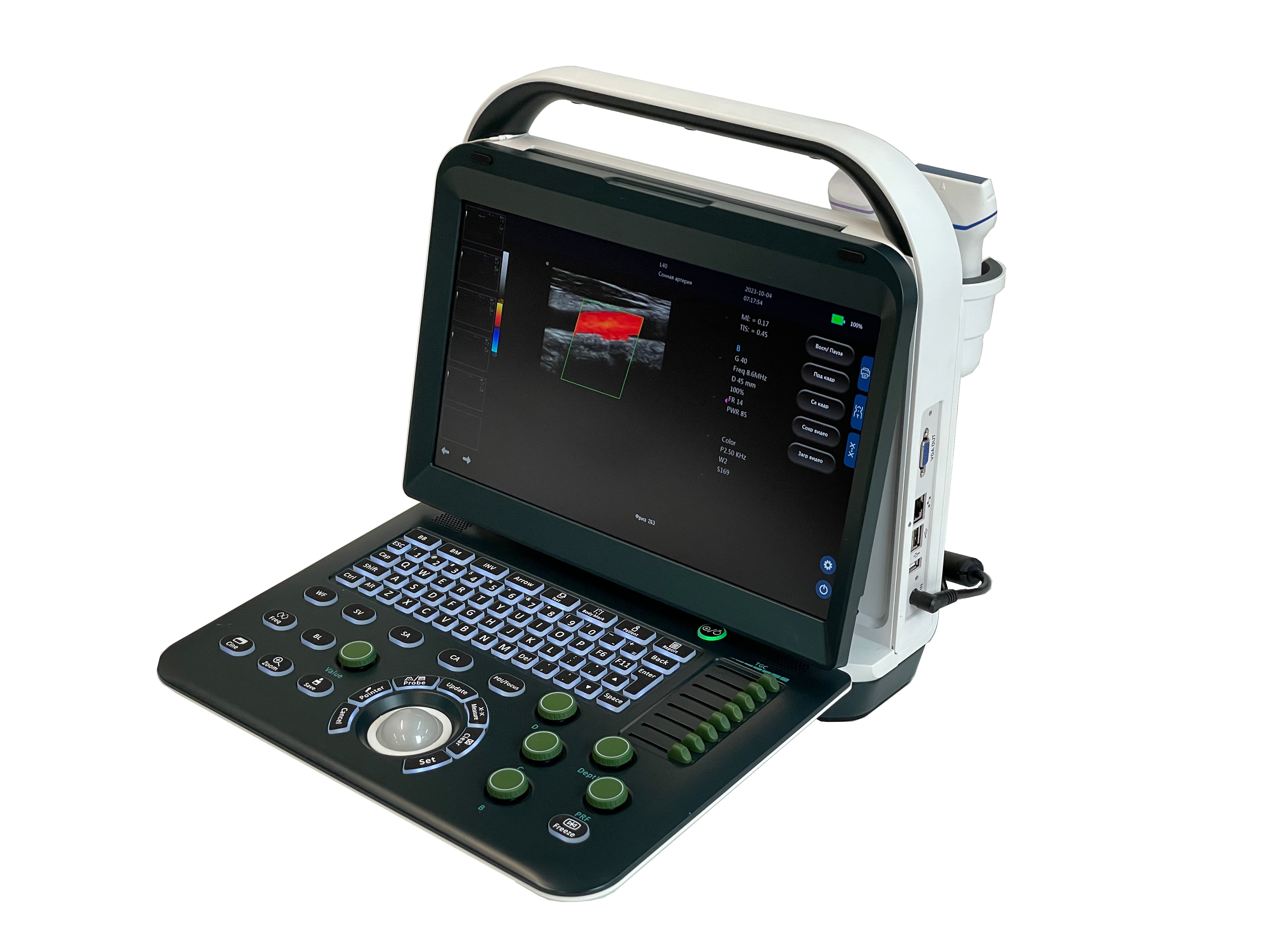 Ультразвуковой сканер AcuVista RS880d 35