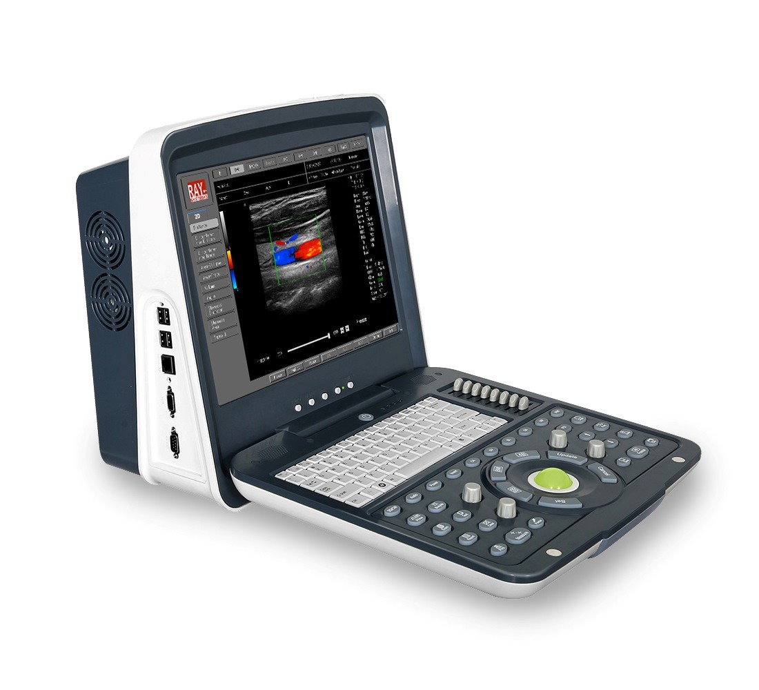 Портативный УЗИ сканер с цветным допплером AcuVista RS880i