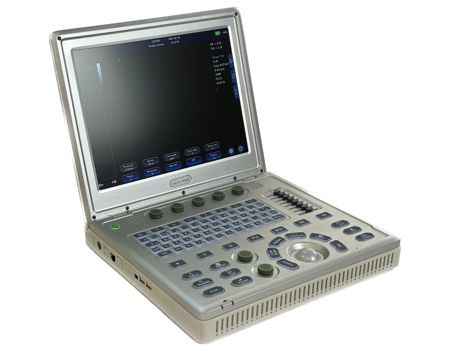 Портативный УЗИ сканер AcuVista RS880c 2
